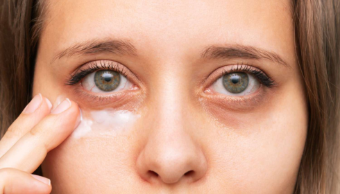 Managing Under-Eye Puffiness from Late Nights and High Salt Meals