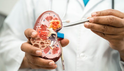Kidney Care in Focus: A Practical Guide to Nephrology Services in India